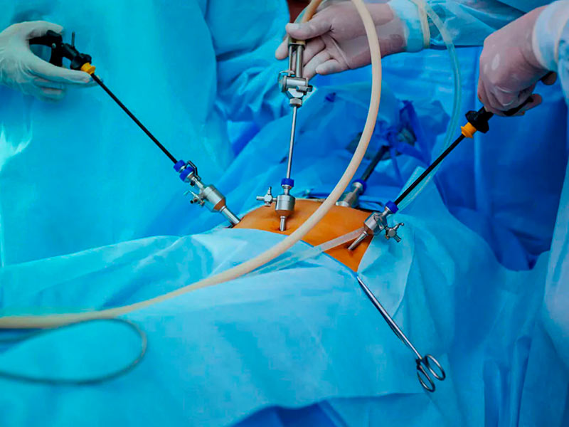 cirurgias bariátricas revisionais